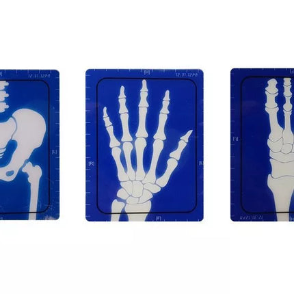 Medicinos rinkinio aparatas Medicinos reikmenys Rentgeno gydytojas